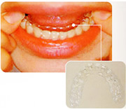 sec3_image